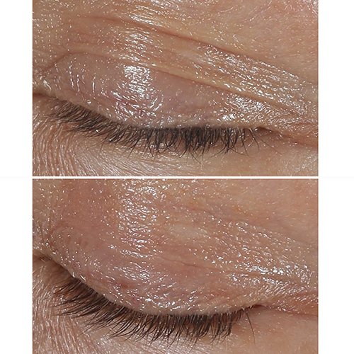 CLINIQUE Smart Clinical Repair - Crème Yeux Correction Rides